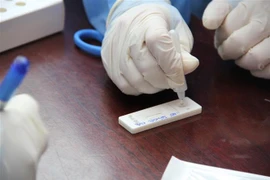 Lấy mẫu xét nghiệm COVID-19. (Ảnh: Văn Hướng/TTXVN) 