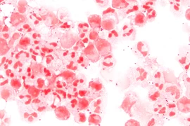 Vi khuẩn Neisseria meningitidis. (Nguồn: Wikipedia)