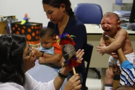 Trẻ em bị mắc chứng bệnh đầu nhỏ do nhiễm virus Zika được điều trị tại Trung tâm phục hồi chức năng ở Recife, Brazil ngày 25/2 vừa qua. (Ảnh: THX/TTXVN)