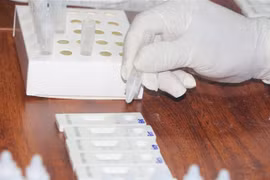 Xét nghiệm test nhanh SARS-CoV-2. (Ảnh: Bích Huệ/TTXVN)