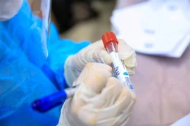 Lấy mẫu xét nghiệm SARS-CoV-2. (Ảnh: Thành Đạt/TTXVN)