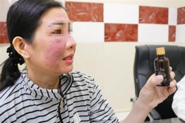Bệnh nhân bị tai biến da và lọ mỹ phẩm làm trắng da cấp tốc bán trên mạng xã hội. (Ảnh: TTXVN phát)