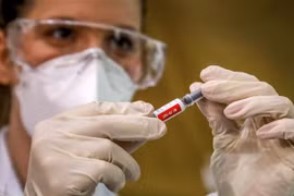 Nhân viên y tế chuẩn bị tiêm thử nghiệm vaccine phòng COVID-19 cho một tình nguyện viên tại Porto Alegre, Brazil, ngày 8/8/2020. (Ảnh: AFP/TTXVN)
