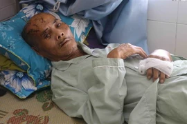 Ông Đoàn Tám đang điều trị tại Khoa Chấn thương Chỉnh hình-Bệnh viện Đa khoa tỉnh Phú Yên. (Ảnh: Phạm Cường/TTXVN)