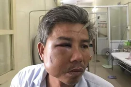 Khởi tố đối tượng đánh nhân viên Trung tâm công viên cây xanh ở Huế