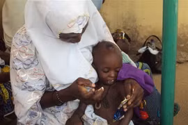 Trẻ em suy dinh dưỡng tại thành phố Gombe, Nigeria. (Ảnh: AFP/TTXVN)