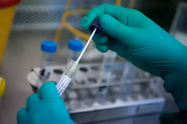 Nghiên cứu viên làm việc trên mẫu bệnh phẩm chứa virus corona chủng mới 2019-nCoV tại phòng thí nghiệm ở Stuttgart, miền Nam Đức ngày 29/1/2020. (Ảnh: AFP/TTXVN)