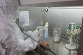 Tách chiết mẫu bệnh phẩm. (Ảnh minh họa. Nguồn: TTXVN)