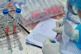 Nhân viên y tế của Trung tâm kiểm soát bệnh tật thành phố (CDC Hà Nội) tiến hành lấy mẫu xét nghiệm cho người dân. (Ảnh: Minh Quyết/TTXVN)