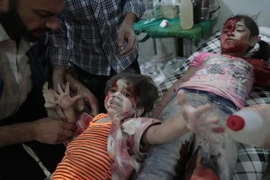 Trẻ em bị thương trong xung đột giữa quân Chính phủ Syria và lực lượng nổi dậy ở thị trấn Douma, phía Đông thủ đô Damascus. (Nguồn: AFP/TTXVN)