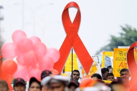 Bệnh nhân HIV có thể chịu ít nguy cơ mắc bệnh đa xơ cứng 