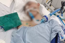 Cháu Đ bị đánh gây thương tích nặng. 