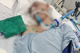 Cháu Đ bị đánh gây thương tích nặng. 