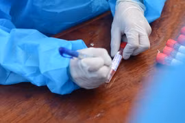 Mẫu xét nghiệm COVID-19. (Ảnh: Văn Dũng/TTXVN)