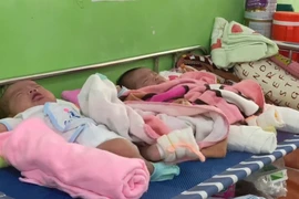 Do số bệnh nhi nhập viện tăng đột biến nên 2 bệnh nhi phải nằm chung giường tại Bệnh viện Nhi đồng 1. (Ảnh: Đinh Hằng/TTXVN)