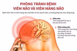 [Infographics] Phòng tránh bệnh viêm não và viêm màng não