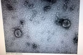 Viện vệ sinh dịch tễ Trung ương đã nuôi cấy và phân lập thành công virus corona mới. (Nguồn: Bộ Y tế)