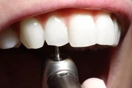 Với tiện ích mới, bệnh nhân sẽ không còn phải nghe tiếng máy khoan "ghê sợ" của nha sĩ. (Ảnh: Internet)