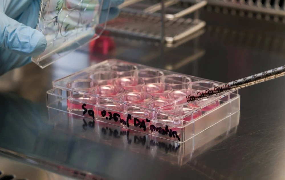 Điều trị bệnh suy tim nặng bằng phương pháp cấy ghép cơ tim từ tế bào iPS