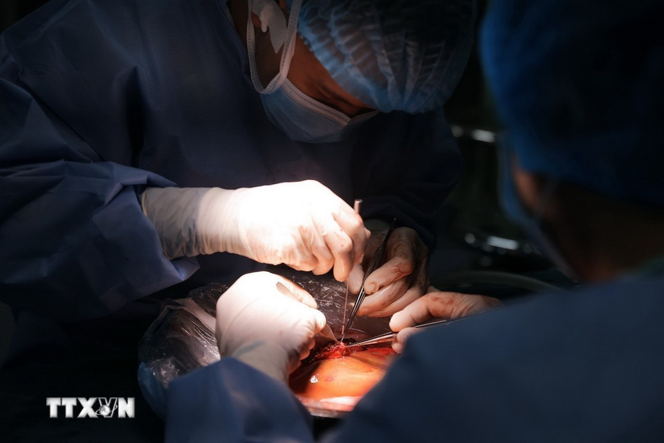 Bác sỹ tiến hành rửa gan ngay sau khi lấy ra từ người hiến. (Ảnh: Minh Quyết/TTXVN)