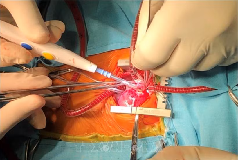 Ảnh minh họa. (Nguồn: Internet)