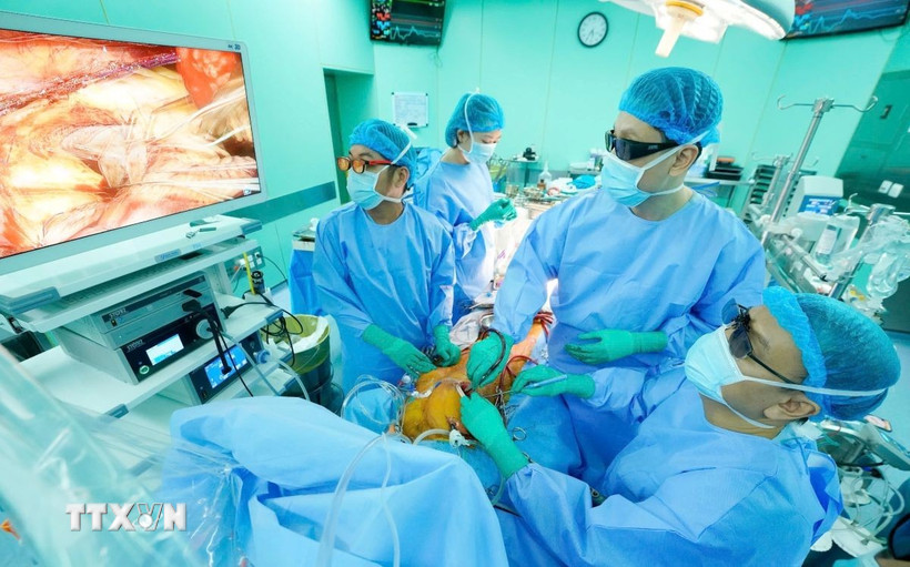 Các bác sỹ Bệnh viện Đại học Y dược Thành phố Hồ Chí Minh thực hiện phẫu thuật nội soi 3D thay van động mạch chủ kết hợp bắc cầu mạch vành. (Ảnh: TTXVN phát)