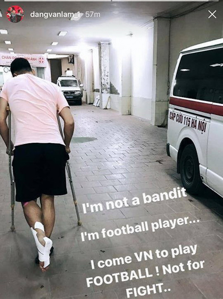 Không lâu sau khi trở về từ đội tuyển, Văn Lâm bị trợ lý, đàn anh Lê Sỹ Mạnh hành hung. Anh rời câu lạc bộ sau đó không lâu để đảm bảo an toan cho bản thân. Nhiều nguồn tin tiết lộ nhóm “đại ca” Hải Phòng không ưa thủ môn 24 tuổi vì họ cho rằng anh “chảnh, kiêu ngạo sau khi trở về từ đội tuyển.” (Ảnh: Instagram Đặng Văn Lâm)