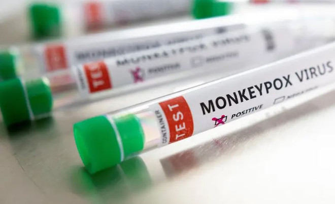 Israel phát hiện thêm một trường hợp nhiễm đậu mùa khỉ ảnh 1