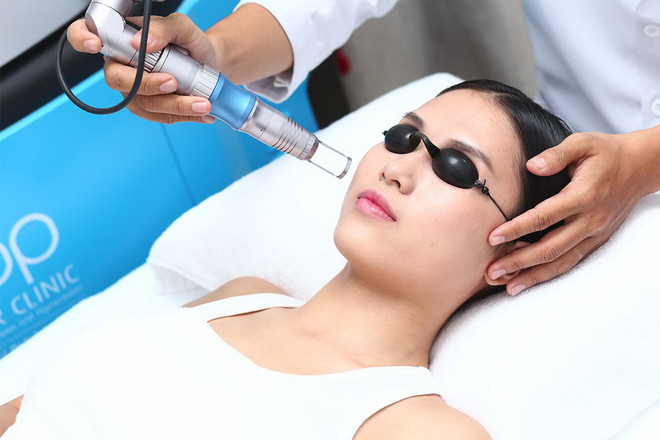 4 phương pháp trị vết chân chim quanh mắt hiệu quả nhất ảnh 4