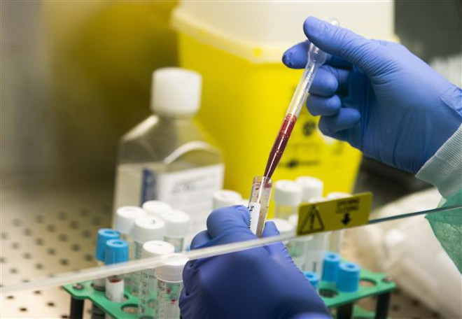 Italy: 6 loại vắcxin phòng COVID-19 đang có kết quả khả quan ảnh 1