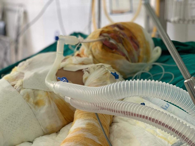 Tận cùng nỗi đau gia đình thiếu phụ bị tẩm xăng đốt nhà ảnh 2