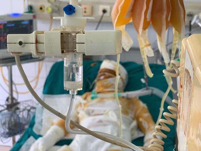 Tận cùng nỗi đau gia đình thiếu phụ bị tẩm xăng đốt nhà ảnh 1