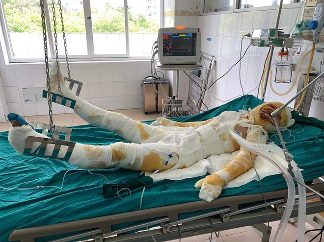 Tận cùng nỗi đau gia đình thiếu phụ bị tẩm xăng đốt nhà ảnh 3