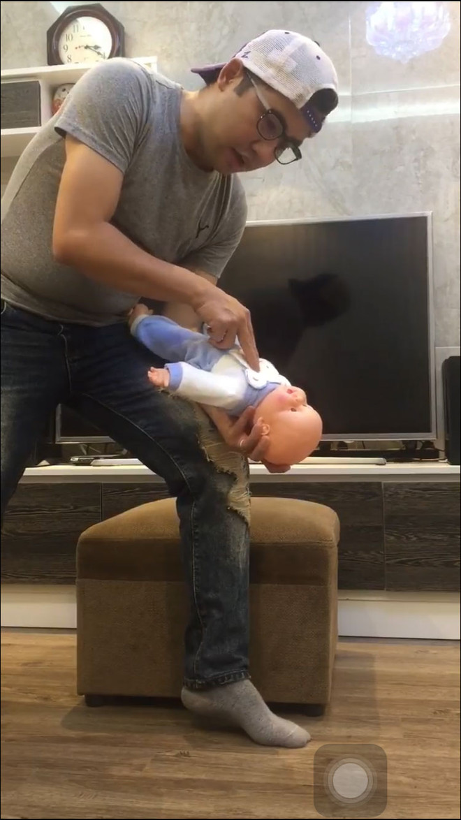 Cứu trẻ bị hóc dị vật: Người lớn chỉ có 4 phút vàng ngọc! ảnh 3