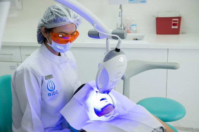 Những điều cần cân nhắc trước khi tẩy trắng răng bằng laser ảnh 3