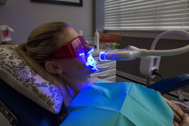 Những điều cần cân nhắc trước khi tẩy trắng răng bằng laser ảnh 2