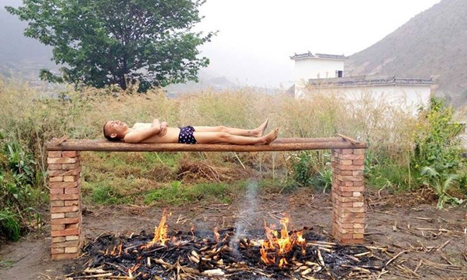 Tự "nướng" - cách chữa trị ung thư độc đáo của chàng trai 25 tuổi ảnh 1