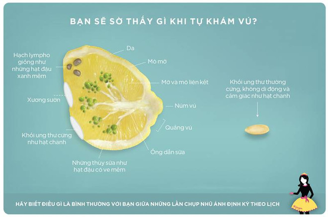 Tự kiểm tra dấu hiệu mắc ung thư vú qua hình ảnh cắt lát của quả chanh ảnh 1