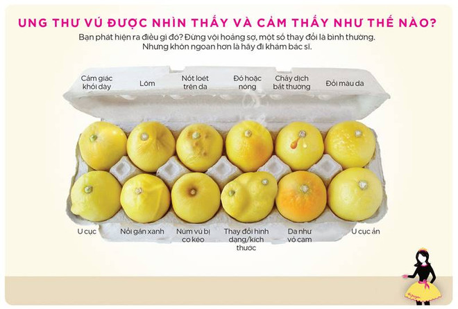 Tự kiểm tra dấu hiệu mắc ung thư vú qua hình ảnh cắt lát của quả chanh ảnh 2