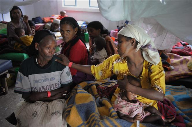 Trẻ em bị suy dinh dưỡng được điều trị tại trung tâm y tế ở Kuyera, Ethiopia. (Ảnh: AFP/TTXVN) Hơn 20 triệu trẻ em thuộc vùng Sừng châu Phi đối mặt nạn đói ảnh 1