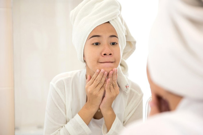 Nhận diện và xử trí dứt điểm mụn nội tiết - nỗi phiền toái cho phụ nữ ảnh 1