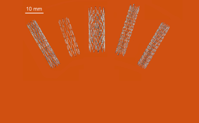 Australia tạo đột phá trong sản xuất stent nhờ công nghệ in 3D ảnh 1