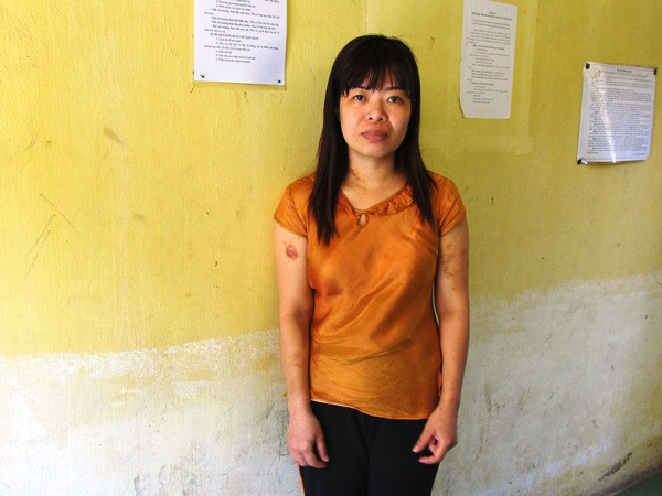 Khởi tố chị dâu dùng búa tấn công em dâu do nợ nần cờ bạc ảnh 1