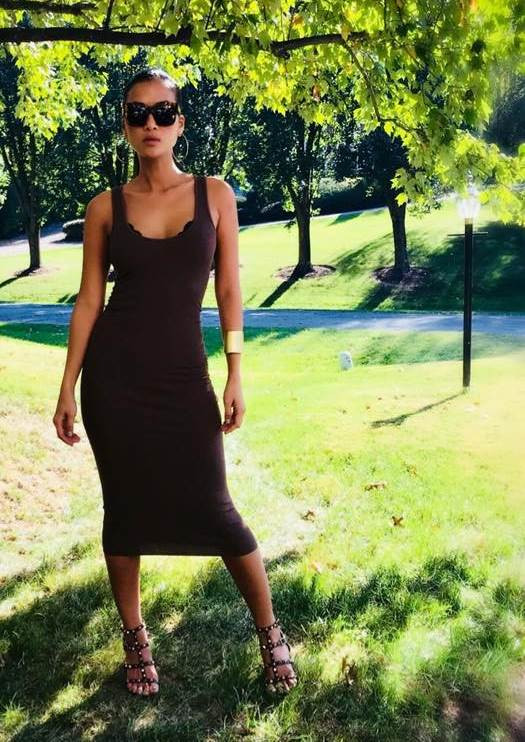 Cựu siêu mẫu Bằng Lăng: Tàn nhang là… “bảo bối” nên phải giữ gìn ảnh 3