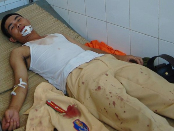 Dũng cảm cứu người, thiếu úy Cảnh sát giao thông bị côn đồ chém ảnh 1