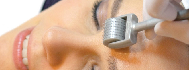 Những điều cần biết về phương pháp Micro Needling - lăn kim vi điểm ảnh 2