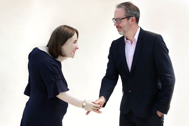 Giới văn phòng sau 20 năm bàn giấy: Giãn tĩnh mạch, bụng to, lưng gù? ảnh 1