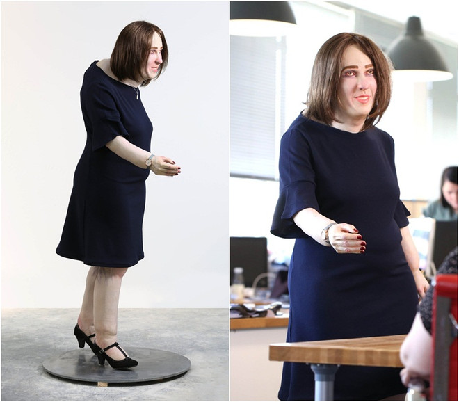 Giới văn phòng sau 20 năm bàn giấy: Giãn tĩnh mạch, bụng to, lưng gù? ảnh 2