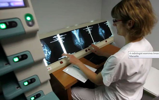 Phát hiện mới giúp cảnh báo sớm bệnh ung thư sắp chuyển sang di căn ảnh 1