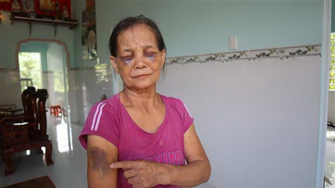 Bình Phước xử phạt hành chính con dâu đánh mẹ chồng bầm dập ảnh 1